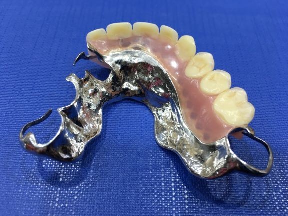 Metal Partial Denture 