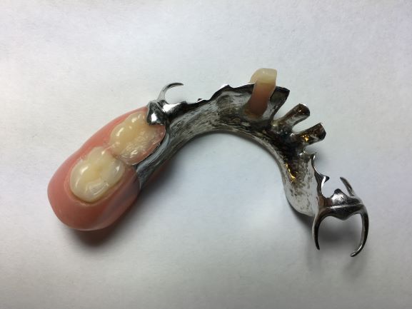 Partial denture metal 
