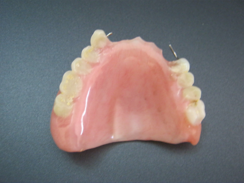 Partial denture acrylic